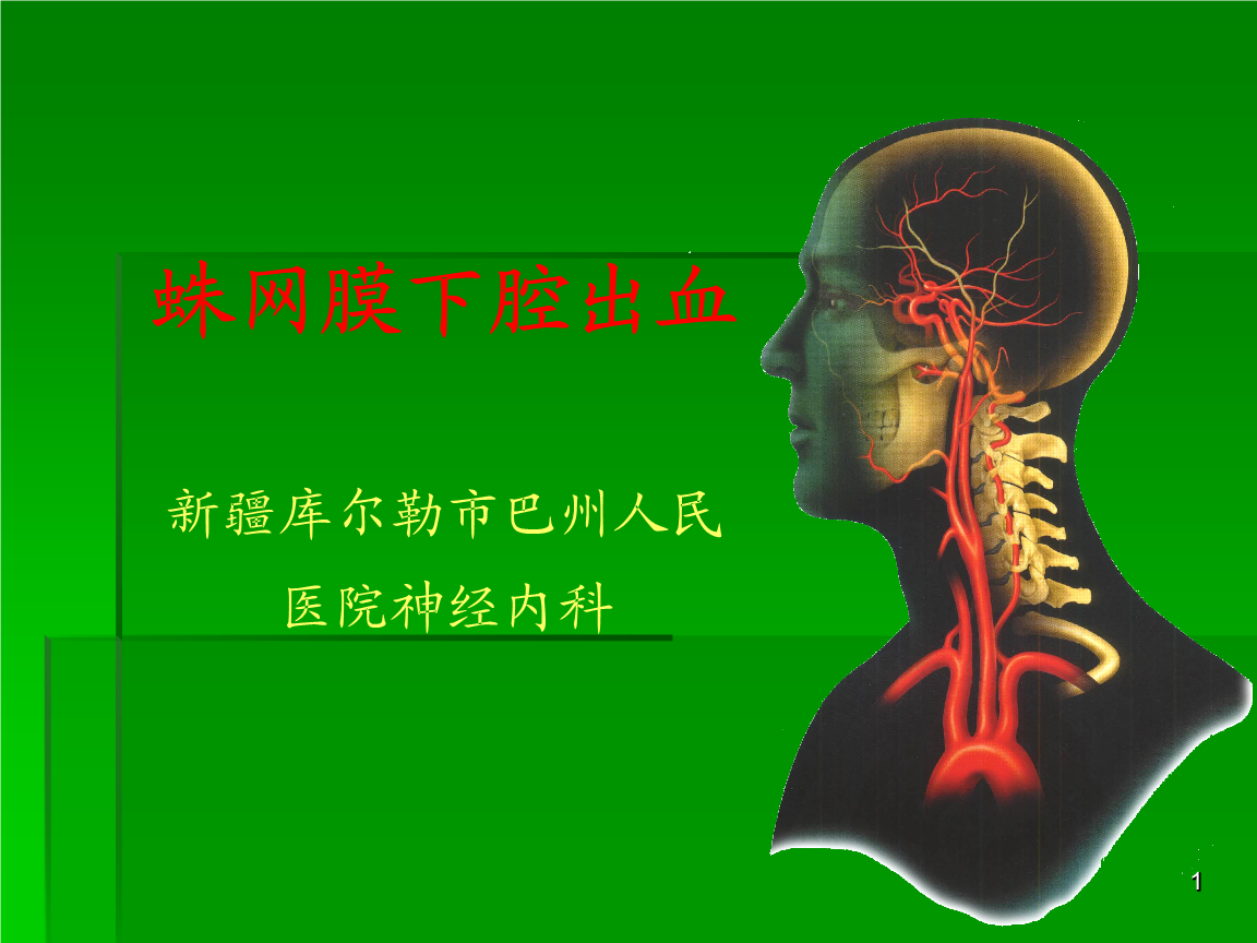蛛網(wǎng)膜下腔出血課件課件篇.ppt