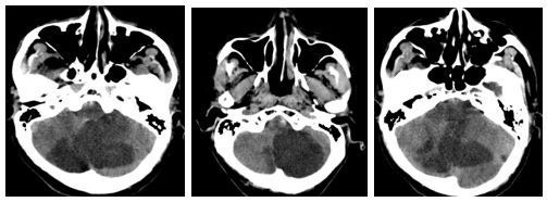 邢臺市第九醫院神經內科二區 專業守護，實績突出的神經健康守護者